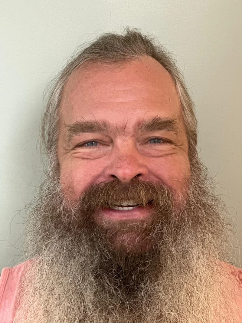 Patient smile after full-mouth restoration