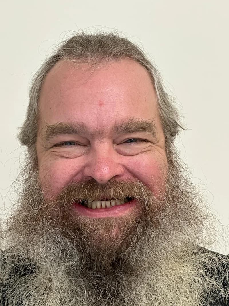 Patient smile before full-mouth restoration